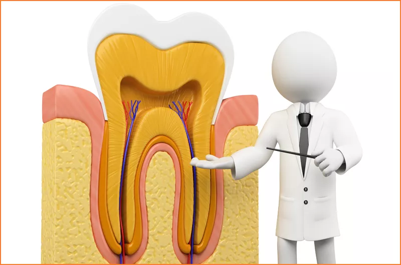 Root Canal Treatment