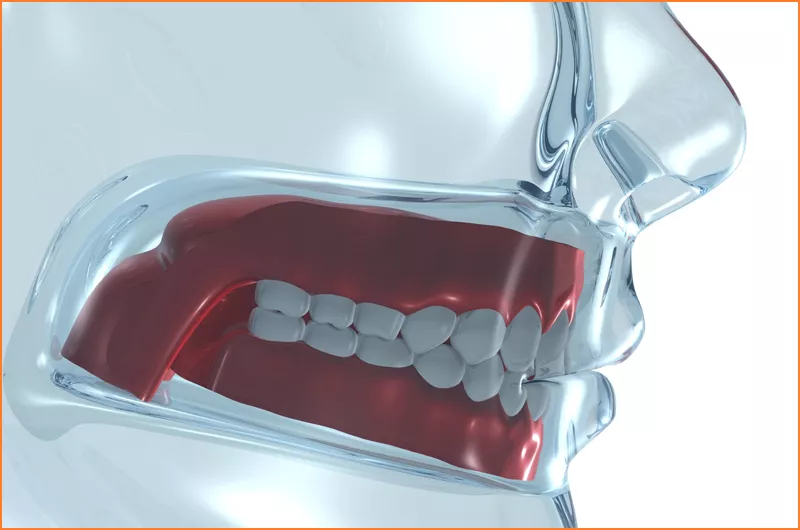 Dental Sleep Medicine
